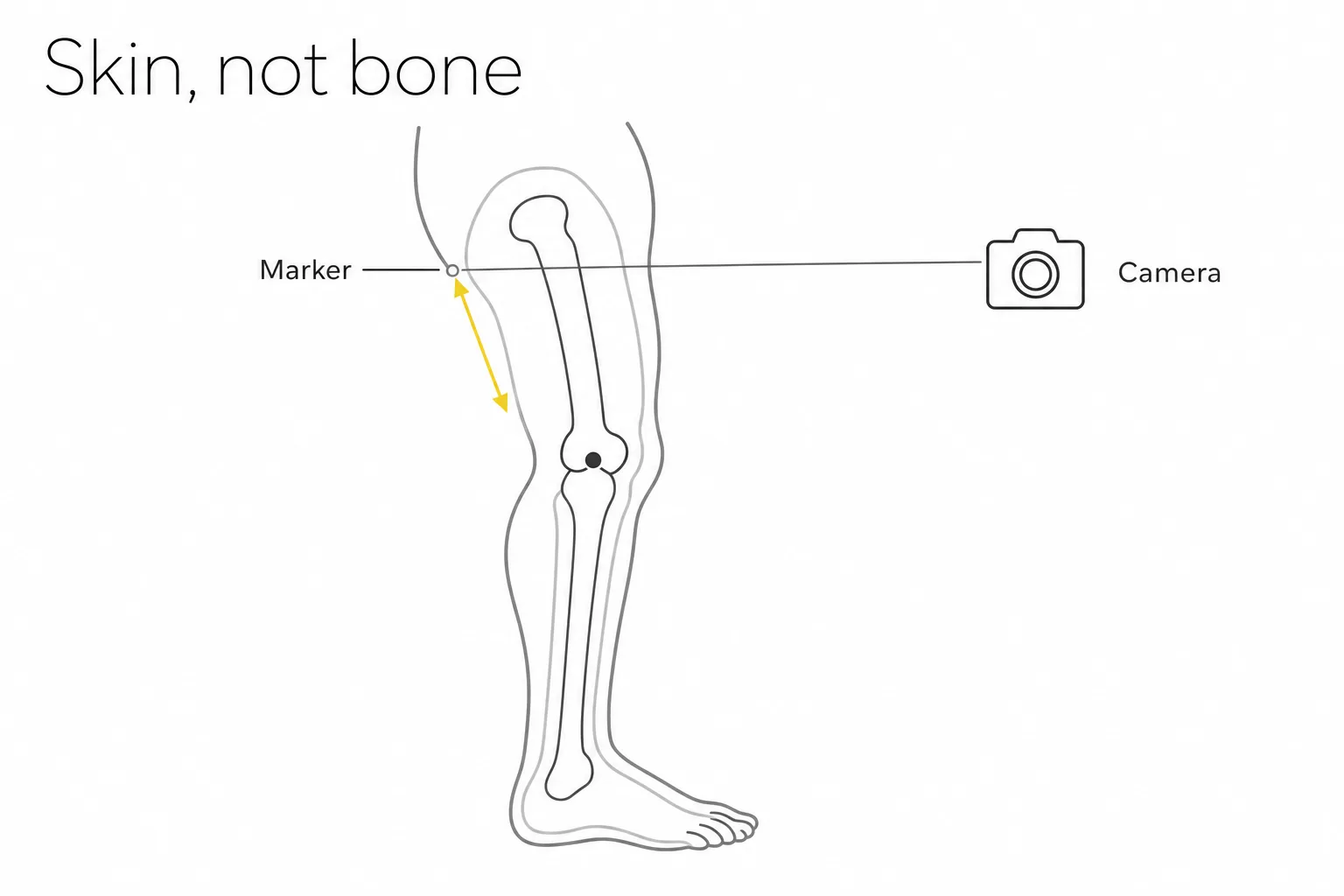 Diagram showing marker-based and camera-based systems both reading the skin surface while bone motion sits underneath